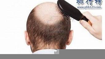 2024年脫發產品排行榜前十名 科學評測與選購指南